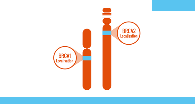 Altération des gènes BRCA1 ou BRCA2 quels risques